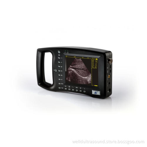 Palmsize B/W Digital Ultrasound